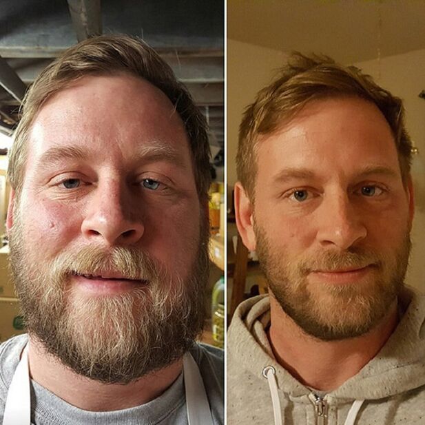 appearance of the person before and after giving up alcohol